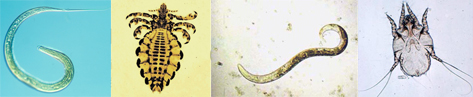 Eprimec Infestacion Parasitaria